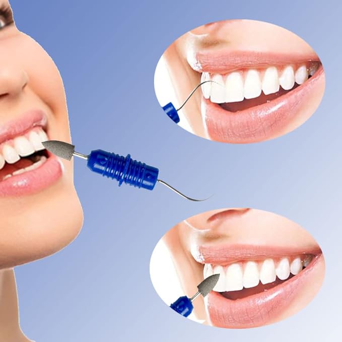 2PCS Reusable Dental Picks Kit Portable Teeth Stain Plaque Remover with Keychain with Keychain Tooth Erasers Tartar Eraser Tool Set for Travel, Pets & Oral Hygiene, Blue