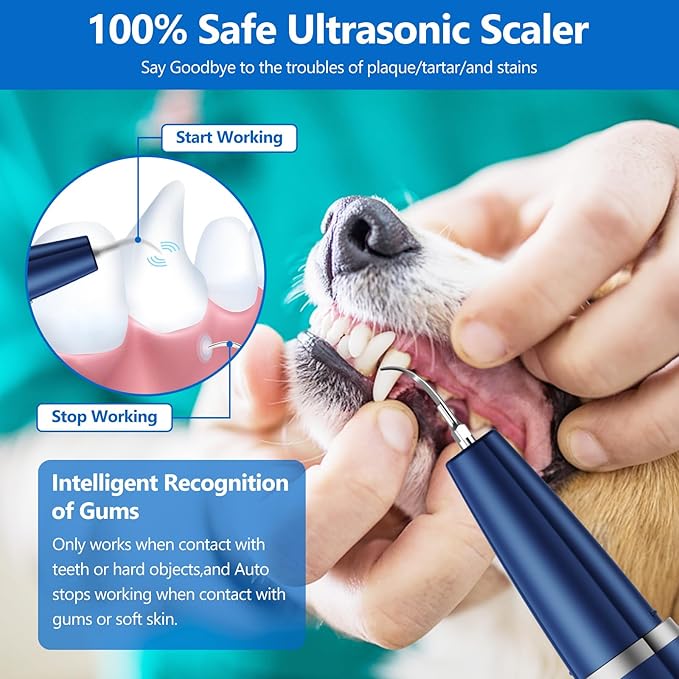 Ni-SHEN Dog Plaque Remover for Teeth,Pet Ultrasonic Tooth Cleaner,Teeth Cleaning Kit -Tartar Remover for Teeth Stains for Dogs and Cats (Blue)