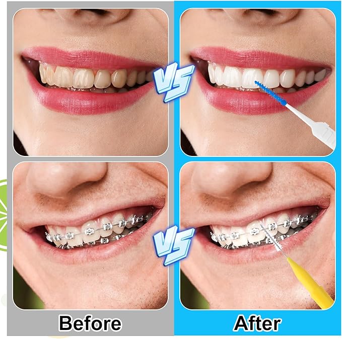 255 Pieces Braces Flossers for Braces, Interdental Brush Soft Dental Floss Picks Braces Cleaning Kit Toothpick Dental Brush Braces Teeth Flossers Brushes for Tooth Cleaner(5 Sizes)